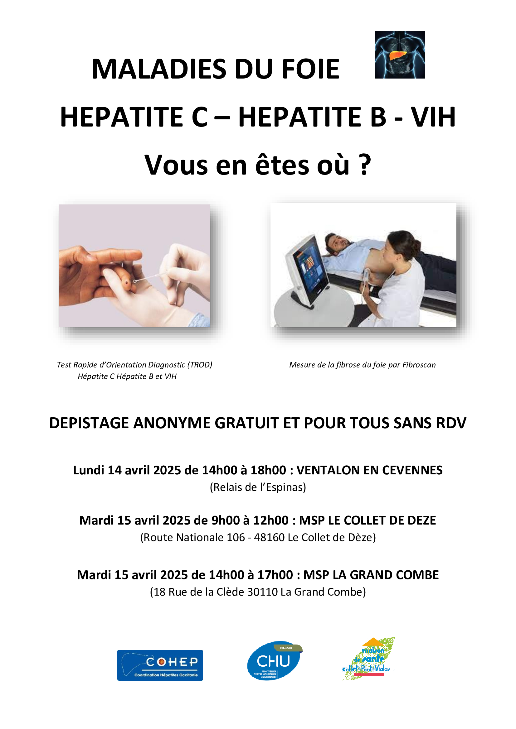DEPISTAGE HEPATITE